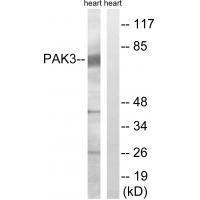 PAK3 (Ab54) Antibody
