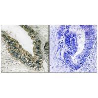 PEK/PERK (Ab-981) Antibody