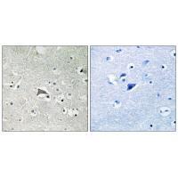 VEGFR1 Antibody