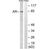 Androgen Receptor (Ab-363) Antibody