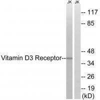 Vitamin D3 Receptor (Ab-51) Antibody