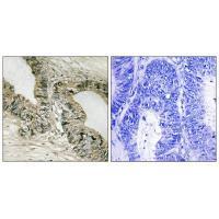 GAB2 (Ab59) Antibody