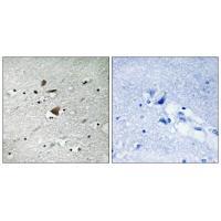 APC1 Antibody