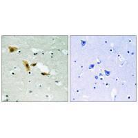 APLF (Ab16) Antibody
