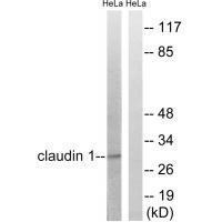 Claudin 1 (Ab-210) Antibody