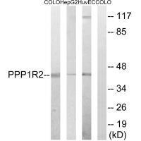 PPP1R2 (Ab-44) Antibody