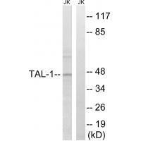 TAL (Ab22) Antibody
