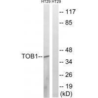 TOB1 (Ab64) Antibody