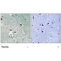 53BP1 Antibody