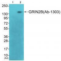 GRIN2B(Ab303) Antibody