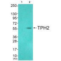 TPH2 (Ab9) Antibody