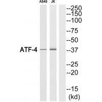 ATF-4 (Ab-219) Antibody