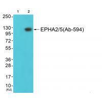 EPHA2/5 (Ab-594) Antibody