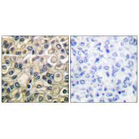 Claudin 1 Antibody