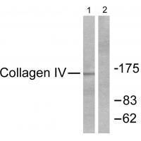 Collagen IV Antibody