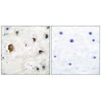 Connexin 43 Antibody