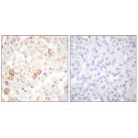 Cyclin F Antibody