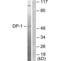 DP Antibody