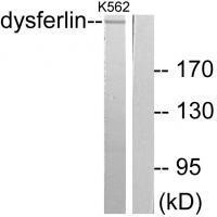 Dysferlin Antibody
