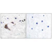 ERAB Antibody