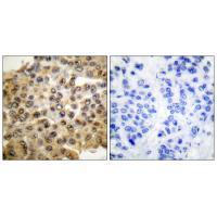 ERK1/2 Antibody