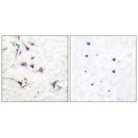 Ezrin Antibody