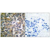 FAP Antibody