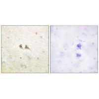 FAS ligand Antibody