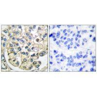 FGFR2 Antibody