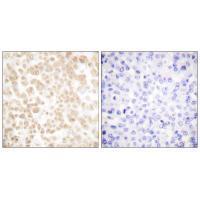 Fra-2 Antibody