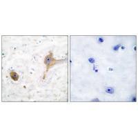GABA B Receptor Antibody