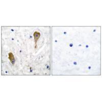 GAD67 Antibody