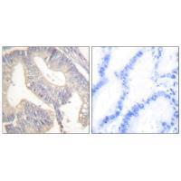Gastrin Antibody