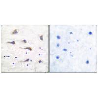 GluR6 Antibody