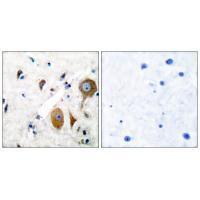 GluR8 Antibody
