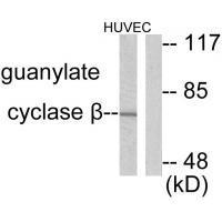 Guanylate Cyclase β Antibody