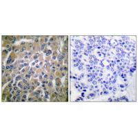 hCG β Antibody
