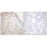 HDAC5 Antibody
