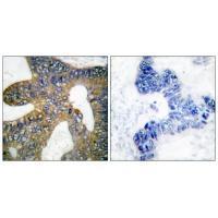 HSP105 Antibody