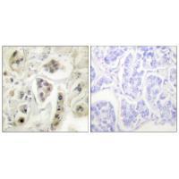 HSP60 Antibody
