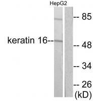 Keratin 16 Antibody