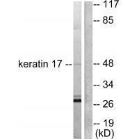 Keratin 17 Antibody