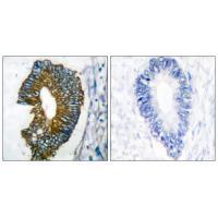 Keratin 18 Antibody