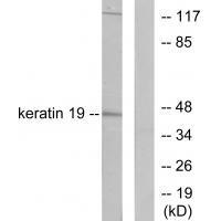 Keratin 19 Antibody