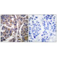 Keratin 20 Antibody