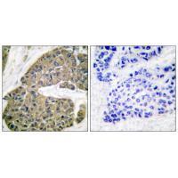Keratin 5 Antibody