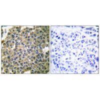 Keratin 7 Antibody