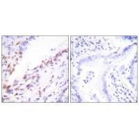 Ki67 Antibody