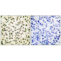 Ku70/80 Antibody