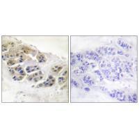 Mammaglobin Antibody